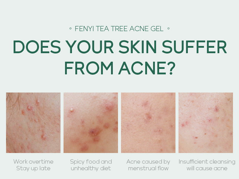 20g Moisturizing Skin Care Product